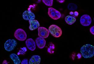 Cellules cancéreuses colorectales humaines traitées avec un inhibiteur de la topoisomérase et un inhibiteur de la protéine kinase ATR (liée à l'ataxie télangiectasie et à Rad3), une combinaison de médicaments à l'étude en tant que thérapie anticancéreuse (Photo).