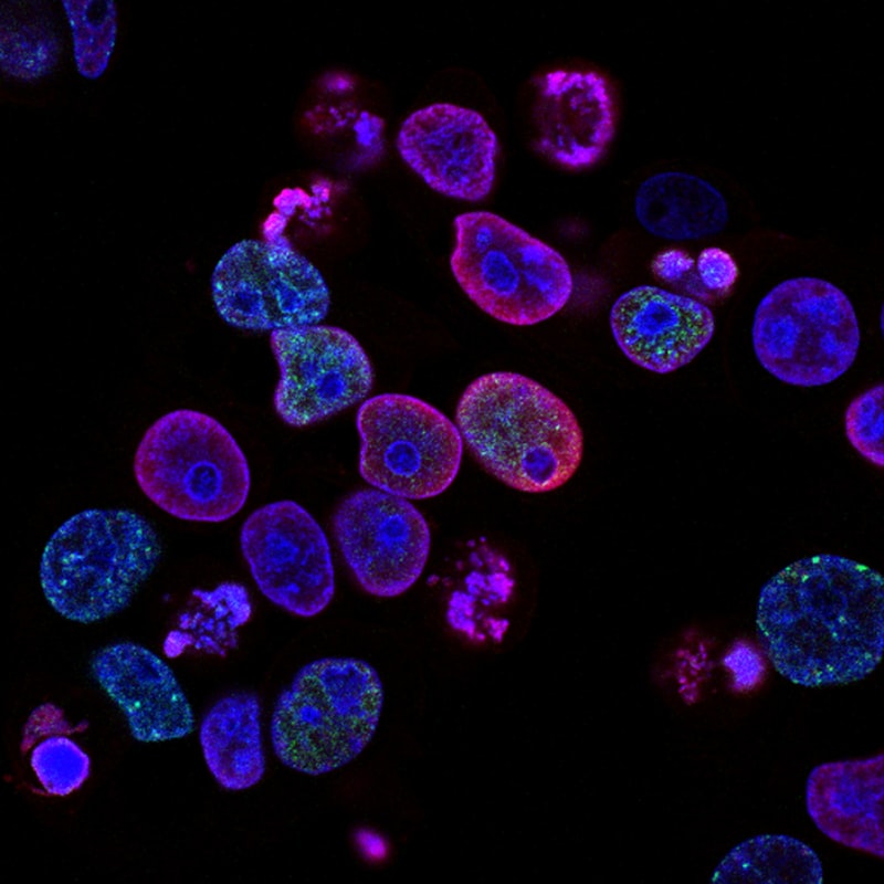 Cellules cancéreuses colorectales humaines traitées avec un inhibiteur de la topoisomérase et un inhibiteur de la protéine kinase ATR (liée à l'ataxie télangiectasie et à Rad3), une combinaison de médicaments à l'étude en tant que thérapie anticancéreuse (Photo).
